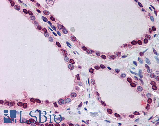 Anti-LPIN1 / Lipin 1 antibody IHC of human thyroid. Immunohistochemistry of formalin-fixed, paraffin-embedded tissue after heat-induced antigen retrieval. Antibody LS-B5838 concentration 5 ug/ml.