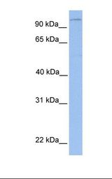 721_B cell lysate. Antibody concentration: 1.0 ug/ml. Gel concentration: 12%.