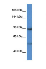 LPIN2 / Lipin 2 antibody LS-C145511 Western blot of HeLa Cell lysate. Antibody concentration 1 ug/ml.