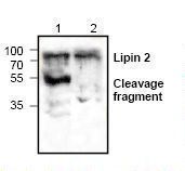 Western blot of LPIN2 / LIPIN-2 antibody LS-C146975.