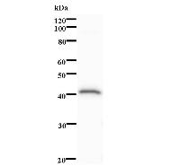 Western blot analysis of immunized recombinant protein, using anti-LPIN2 monoclonal antibody.