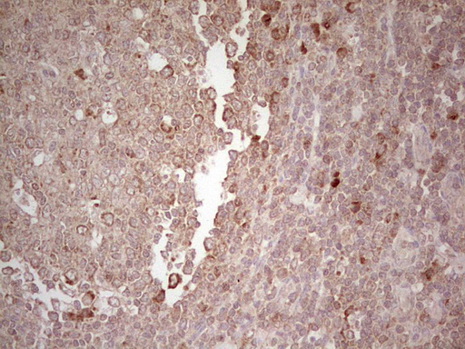 IHC of paraffin-embedded Human tonsil using anti-LPIN3 mouse monoclonal antibody. (Heat-induced epitope retrieval by 1 mM EDTA in 10mM Tris, pH8.5, 120°C for 3min).