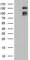 HEK293T cells were transfected with the pCMV6-ENTRY control (Left lane) or pCMV6-ENTRY LPIN3 (Right lane) cDNA for 48 hrs and lysed. Equivalent amounts of cell lysates (5 ug per lane) were separated by SDS-PAGE and immunoblotted with anti-LPIN3.