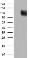 HEK293T cells were transfected with the pCMV6-ENTRY control (Left lane) or pCMV6-ENTRY LPIN3 (Right lane) cDNA for 48 hrs and lysed. Equivalent amounts of cell lysates (5 ug per lane) were separated by SDS-PAGE and immunoblotted with anti-LPIN3.