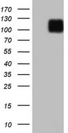 HEK293T cells were transfected with the pCMV6-ENTRY control (Left lane) or pCMV6-ENTRY LPIN3 (Right lane) cDNA for 48 hrs and lysed. Equivalent amounts of cell lysates (5 ug per lane) were separated by SDS-PAGE and immunoblotted with anti-LPIN3.