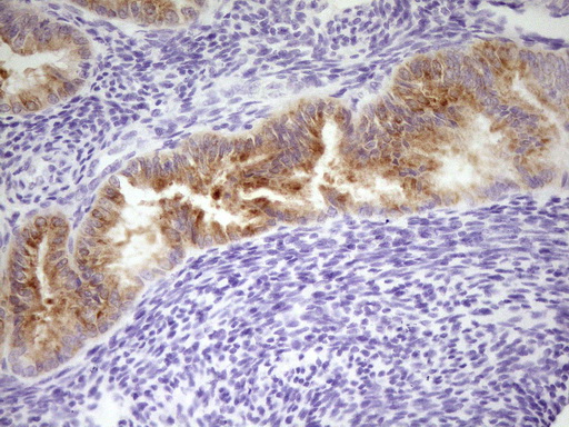 IHC of paraffin-embedded Human endometrium tissue using anti-LPIN3 mouse monoclonal antibody. (Heat-induced epitope retrieval by 1 mM EDTA in 10mM Tris, pH8.5, 120°C for 3min).