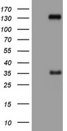 HEK293T cells were transfected with the pCMV6-ENTRY control (Left lane) or pCMV6-ENTRY LPIN3 (Right lane) cDNA for 48 hrs and lysed. Equivalent amounts of cell lysates (5 ug per lane) were separated by SDS-PAGE and immunoblotted with anti-LPIN3.