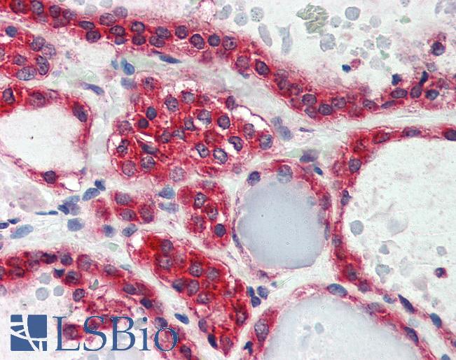 Anti-LPIN3 / Lipin 3 antibody IHC of human thyroid. Immunohistochemistry of formalin-fixed, paraffin-embedded tissue after heat-induced antigen retrieval. Antibody LS-B2499 concentration 5 ug/ml.