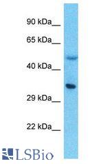 LPPR5 antibody Western Blot of Thymus Tumor. Antibody dilution: 1 ug/ml.