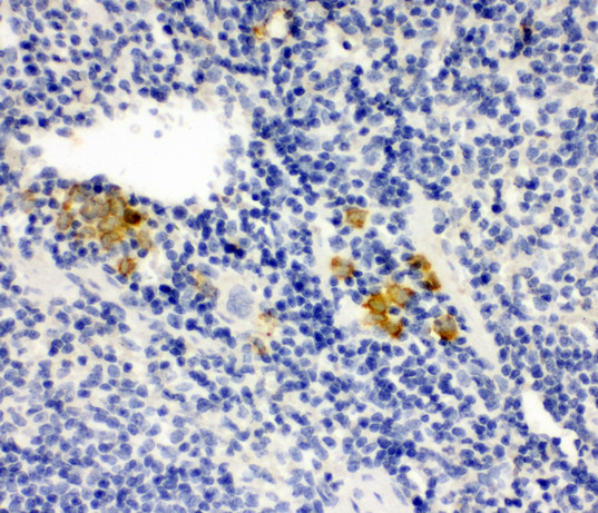 LPXN / Leupaxin antibody. IHC(P): Mouse Spleen Tissue.