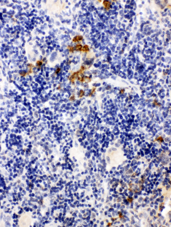 LPXN / Leupaxin antibody. IHC(P): Rat Spleen Tissue.