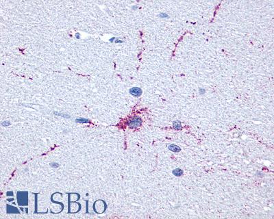 Anti-GRM8 / MGLUR8 antibody LS-A925 IHC of human brain, neurons and glia. Immunohistochemistry of formalin-fixed, paraffin-embedded tissue after heat-induced antigen retrieval.