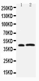 WB of LPXN / Leupaxin antibody. Lane 1: Rat Thymus Tissue Lysate. Lane 2: JURKAT Cell Lysate.