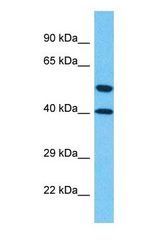 Western blot of LPXN Antibody with human Jurkat Whole Cell lysate.