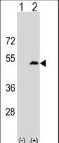 Western blot of LPXN (arrow) using rabbit polyclonal LPXN Antibody. 293 cell lysates (2 ug/lane) either nontransfected (Lane 1) or transiently transfected (Lane 2) with the LPXN gene.