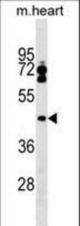 LPXN Antibody western blot of mouse heart tissue lysates (35 ug/lane). The LPXN antibody detected the LPXN protein (arrow).
