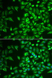 Immunofluorescence analysis of U2OS cell using LRAT antibody. Blue: DAPI for nuclear staining.