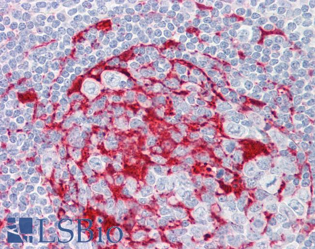 Anti-LRAT antibody IHC of human tonsil. Immunohistochemistry of formalin-fixed, paraffin-embedded tissue after heat-induced antigen retrieval. Antibody LS-B8398 dilution 5 ug/ml.