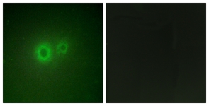 Immunofluorescence of HUVEC cells, using LRAT Antibody. The picture on the right is treated with the synthesized peptide.