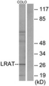 Western blot of extracts from COLO205 cells, using LRAT Antibody. The lane on the right is treated with the synthesized peptide.