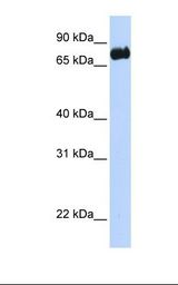 Transfected 293T cell lysate. Antibody concentration: 1.0 ug/ml. Gel concentration: 12%.