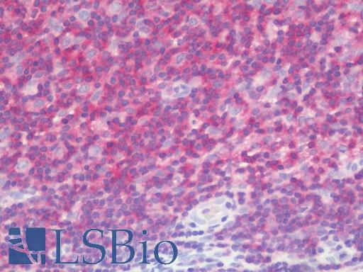 Anti-LRCH4 antibody IHC staining of human tonsil. Immunohistochemistry of formalin-fixed, paraffin-embedded tissue after heat-induced antigen retrieval. Antibody LS-B10996 concentration 10 ug/ml.