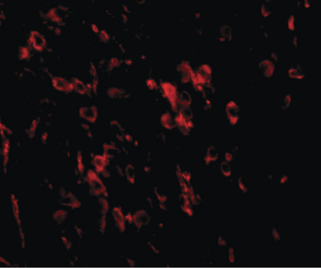 Immunofluorescence of LRFN1 in mouse brain tissue with LRFN1 antibody at 20 ug/ml.