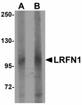 Western blot of LRFN1 in human brain lysate with LRFN1 antibody at (A) 1 and (B) 2 ug/ml. Below: Immunohistochemistry of LRFN1 in mouse brain tissue with LRFN1 antibody at 2.5 ug/ml.