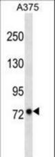 LRFN2 Antibody western blot of A375 cell line lysates (35 ug/lane). The LRFN2 antibody detected the LRFN2 protein (arrow).
