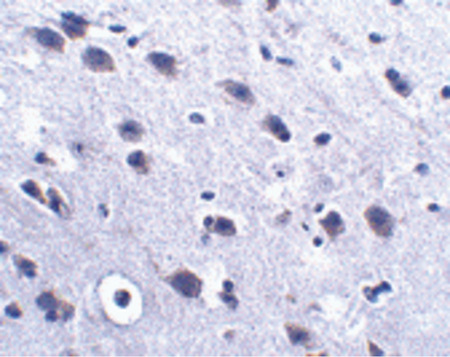 Immunohistochemistry of LRFN2 in mouse brain tissue with LRFN2 antibody at 2.5 ug/ml.