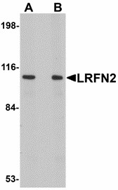 Western blot of LRFN2 in rat brain lysate with LRFN2 antibody at (A) 1 and (B) 2 ug/ml. Below: Immunohistochemistry of LRFN2 in mouse brain tissue with LRFN2 antibody at 2.5 ug/ml.