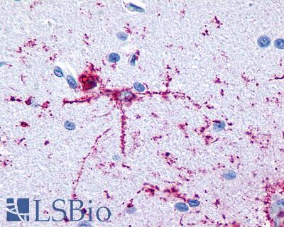 Anti-GRM8 / MGLUR8 antibody LS-A923 IHC of human brain, neurons and glia. Immunohistochemistry of formalin-fixed, paraffin-embedded tissue after heat-induced antigen retrieval.