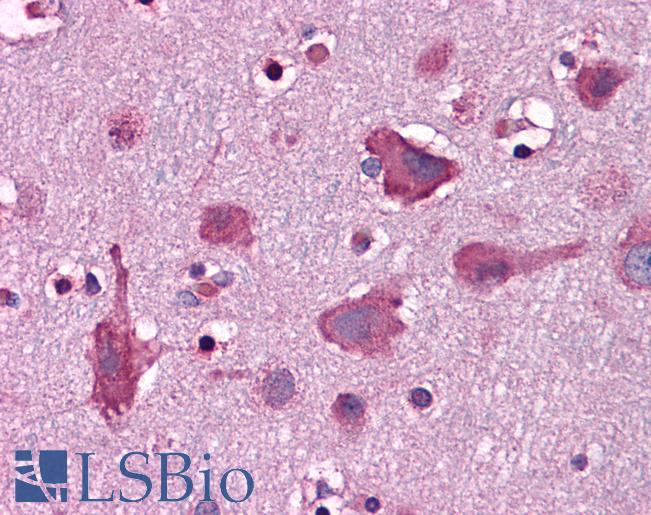 Anti-LRFN3 antibody IHC of human brain, cortex. Immunohistochemistry of formalin-fixed, paraffin-embedded tissue after heat-induced antigen retrieval. Antibody LS-B4994 concentration 5 ug/ml.