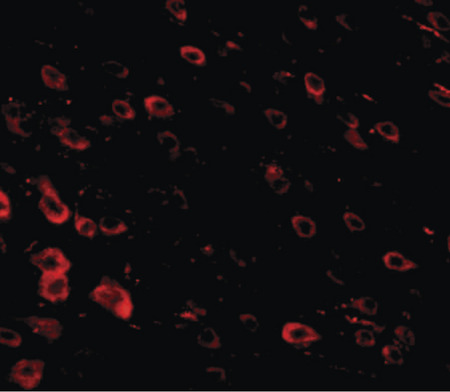 Immunofluorescence of LRFN3 in mouse brain tissue with LRFN3 antibody at 20 ug/ml.