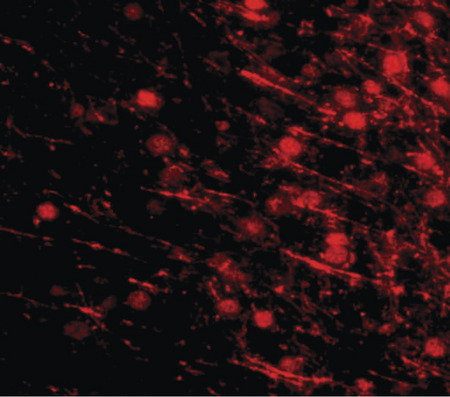 Immunofluorescence of LRFN4 in mouse brain tissue with LRFN4 antibody at 20 ug/ml.