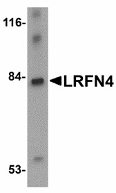Western blot of LRFN4 in rat brain lysate with LRFN4 antibody at 1 ug/ml. Below: Immunohistochemistry of LRFN4 in mouse brain tissue with LRFN4 antibody at 2.5 ug/ml.