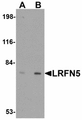 Western blot of LRFN5 in EL4 cell lysate with LRFN5 antibody at (A) 0.5 and (B) 1 ug/ml. Below: Immunohistochemistry of LRFN5 in mouse brain tissue with LRFN5 antibody at 5 ug/ml.