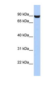LRFN5 antibody LS-C102501 Western blot of HepG2 cell lysate.