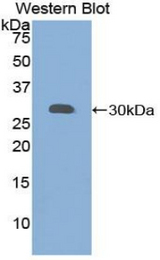 Western blot of recombinant GRN / Progranulin / Granulin.