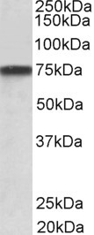 GRN antibody (1 ug/ml) staining of A431 lysate (35 ug protein in RIPA buffer). Primary incubation was 1 hour. Detected by chemiluminescence.