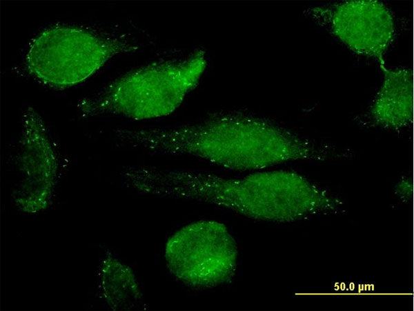 Immunofluorescence of monoclonal antibody to GRN on HeLa cell. [antibody concentration 10 ug/ml]