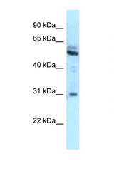 LRMP antibody LS-C145883 Western blot of A549 Cell lysate. Antibody concentration 1 ug/ml.