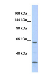 LRP1 / CD91 antibody LS-C102800 Western blot of 721_B cell lysate.
