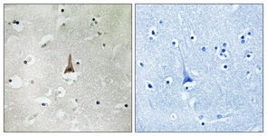 IHC of paraffin-embedded human brain tissue, using LRP10 Antibody. The picture on the right is treated with the synthesized peptide.