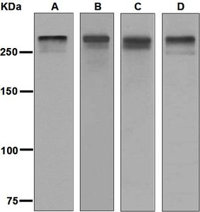 Western blot analysis on (A) human thyroid, (B) 293T, (C) human adrenal gland, and (D) Caco-2 lysates using anti-Megalin antibody.