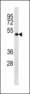 LRP2BP Antibody western blot of A549 cell line lysates (35 ug/lane). The LRP2BP antibody detected the LRP2BP protein (arrow).