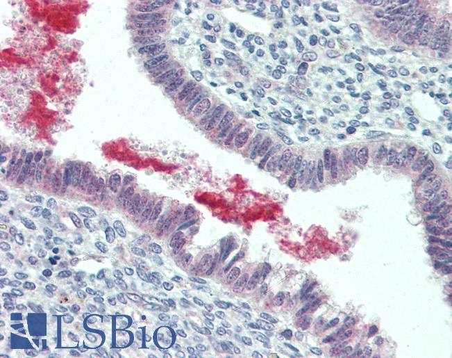 Anti-GRN / Granulin antibody IHC of human uterus. Immunohistochemistry of formalin-fixed, paraffin-embedded tissue after heat-induced antigen retrieval. Antibody LS-B3158 concentration 5 ug/ml.
