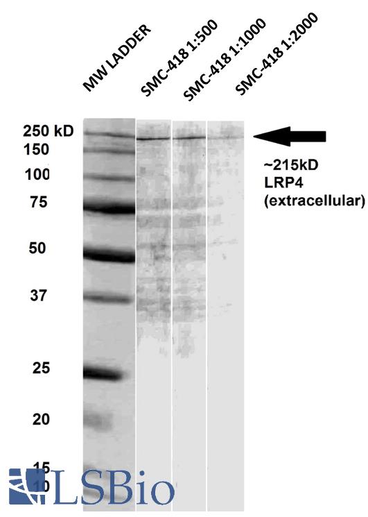 Western blot of rat brain membrane lysates showing the detection of ~215 kDa LRP4 protein using Anti-LRP4 antibody [S207-27] (LRP4 antibody). Lane 1: MW ladder. Lane 2: Anti-LRP4 (1:500). Lane 3: Anti-LRP4 (1:1000). Lane 4: Anti-LRP4 (1:2000). Load: 33 ug RBM per lane. Block: 5% milk + TBST O/N at 4°C. Primary antibody: Mouse Anti-LRP4 antibody [S207-27] (LRP4 antibody) at 1:500,1:1000 1:2000 dilution in TBS for 60 min at RT.