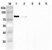 Western blot analysis using anti-Progranulin (mouse), pAb at 1:2000 dilution. 1: Mouse Progranulin (FLAG-tagged). 2: Human Progranulin (FLAG-tagged). 3: Human Granulin C (FLAG-tagged). 4: Human Granulin F (FLAG-tagged). 5: Human ANGPTL3 (FLAG-tagged) (negative control).