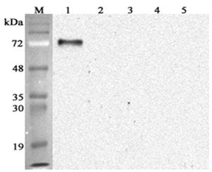 Western blot analysis using anti-Progranulin (mouse), mAb (PG319-1) at 1:2000 dilution. 1: Mouse Progranulin (FLAG-tagged). 2: Human Progranulin (FLAG-tagged). 3: Human Granulin C (FLAG-tagged). 4: Human Granulin (FLAG-tagged). 5: Human DLL1 (FLAG-tagged) (negative control).